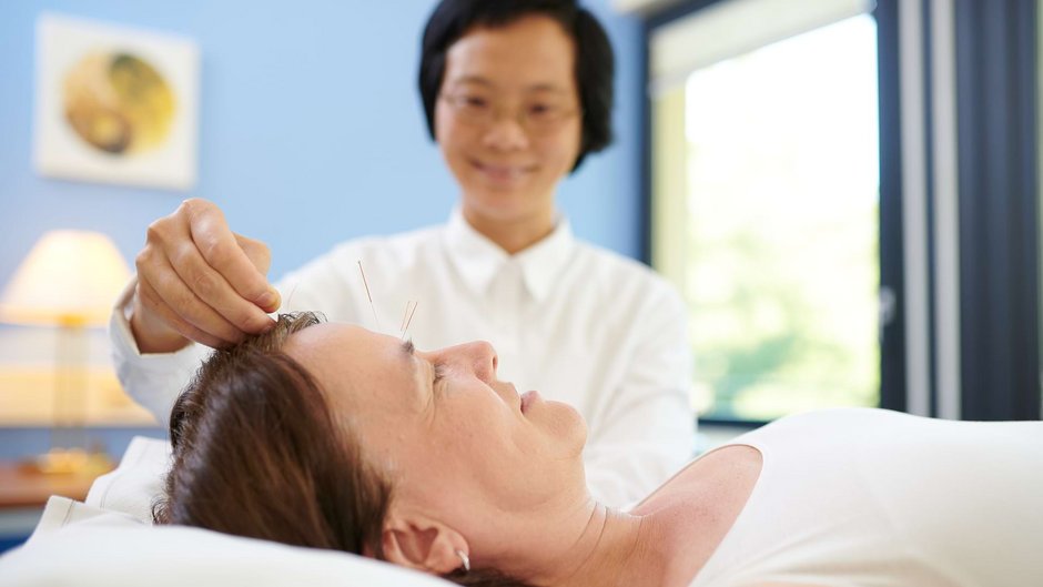 TCM Ärztin setzt Akupunktur Nadeln am Kopf einer Patientin TCM Ärztin setzt Akupunktur Nadeln am Kopf einer Patientin