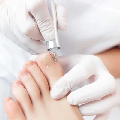 Podologie Füße mit Feile