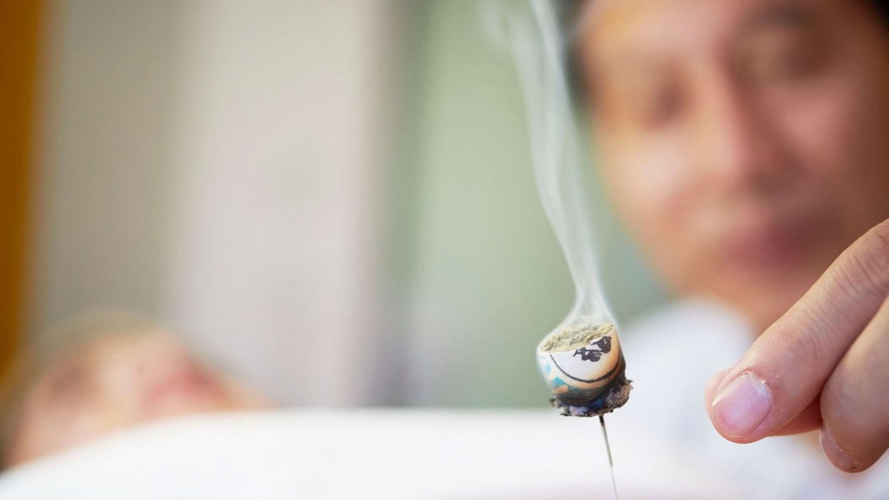 Rauchende Akkupunkturnadel bei einer TCM Behandlung